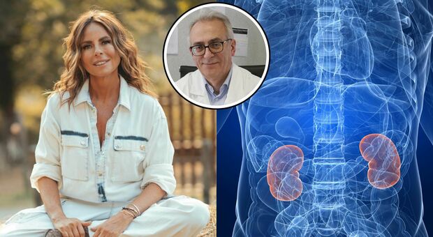 Paola Perego e il tumore al rene loncologo È un cancro silente