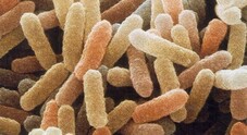 Germania: 4 morti per würstel contaminati da listeria