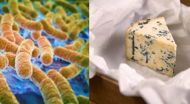 Escherichia coli, bimbo mangia il formaggio blu e muore