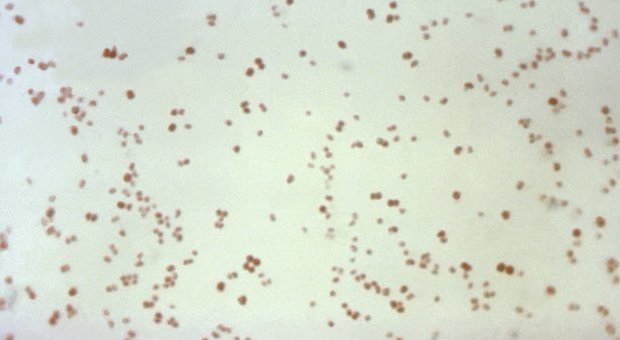 I batteri della gonorrea neisseria, uno dei cinque germi letali indicati dai Cdc