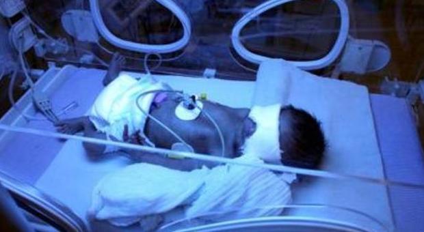 Infezione killer negli ospedali: 18 neonati morti negli ultimi tre mesi