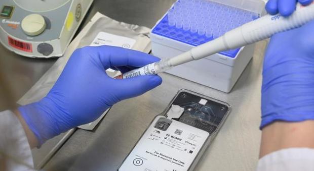 Test sierologici negli ospedali: per la popolazione si aspetta