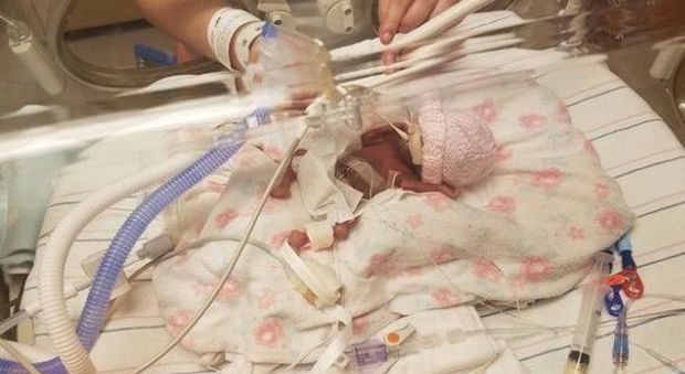 La bimba pesa 2,5 etti, i genitori decidono di farla nascere: la piccola muore 3 giorni dopo