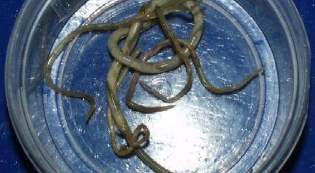 Infezione da vermi intestinali in una scuola di Pozzuoli: è psicosi