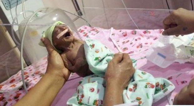 La bimba nasce prematura e malata, i genitori la abbandonano: "Spaventava il fratellino"