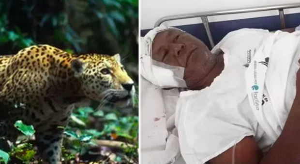 Zio salva i nipoti dall'attacco di un giaguaro. Gli sono stati applicati 150 punti di sutura