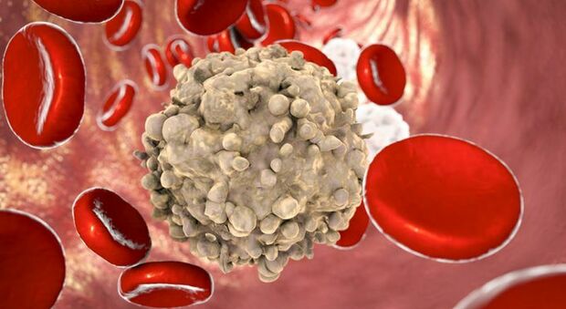 Nuova proteina coinvolta nell'insorgenza della leucemia: lo studio made in Campania
