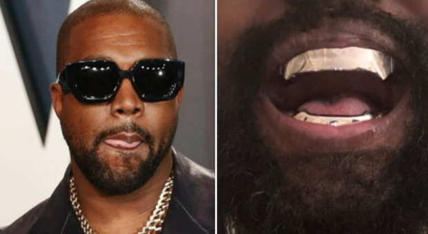 Kanye West si è fatto rimuovere i denti e li ha sostituiti con lastre di titanio