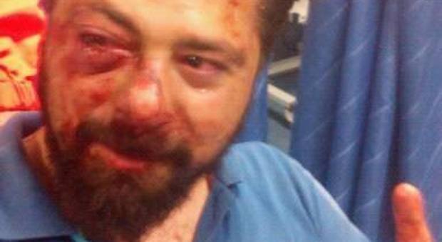 Napoli, l'amico picchiato in diretta telefonica «Assurdo, gli hanno rotto il naso e le dita»