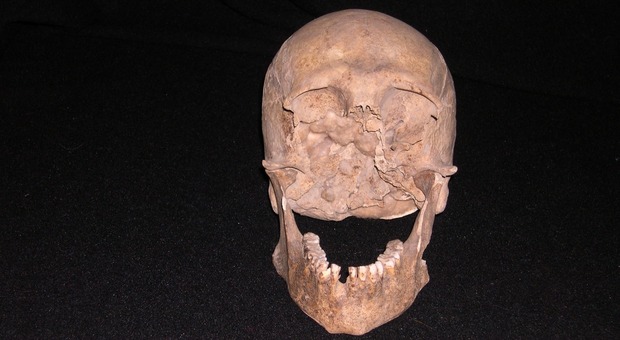 Il presunto cranio di Plinio il Vecchio.