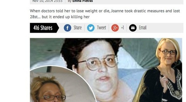 Perde 170 chili con bendaggio gastrico: muore per le complicazioni 16 anni dopo