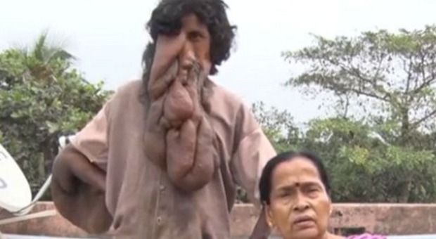 In India l'uomo con la 'proboscide': "È venerato come un dio"