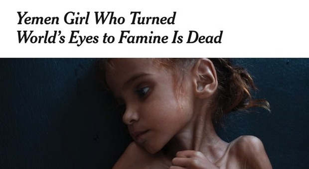 È morta di fame Amal, aveva solo 7 anni. La sua foto sul Ny Times aveva sconvolto il mondo