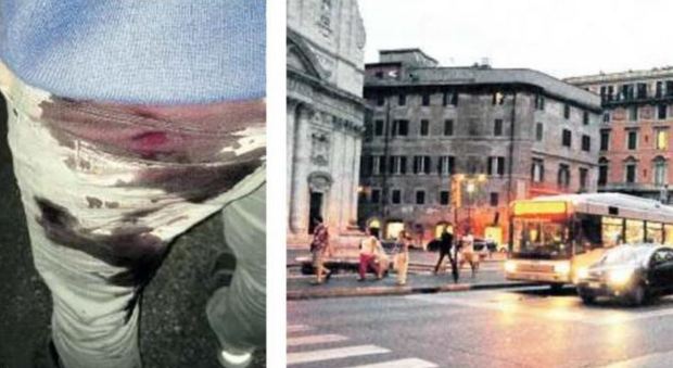 Roma, aggrediti in Centro a coltellate: «Erano due 20enni, volevano divertirsi»