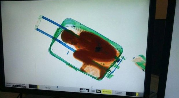 L'immagine della valigia ai raggi X con il piccolo Abou all'interno