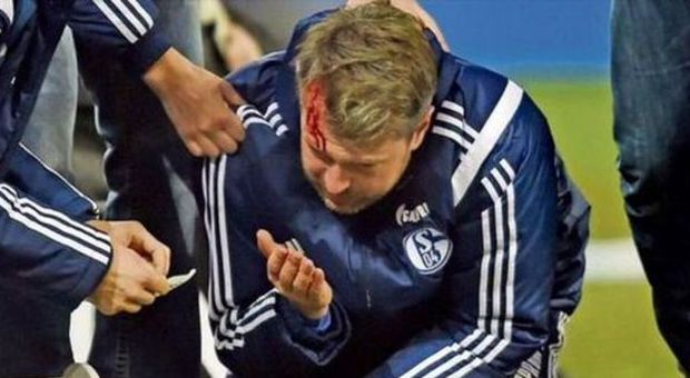 Accendino lanciato dai tifosi ferisce alla testa vice-allenatore dello Schalke 04