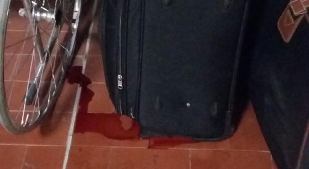 Malpensa, dall'Africa con i trolley sporchi di sangue: scena horror in aeroporto