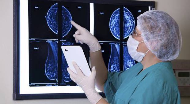 Tumore al seno, nuova cura aumenta del 70% la sopravvivenza per le giovani donne