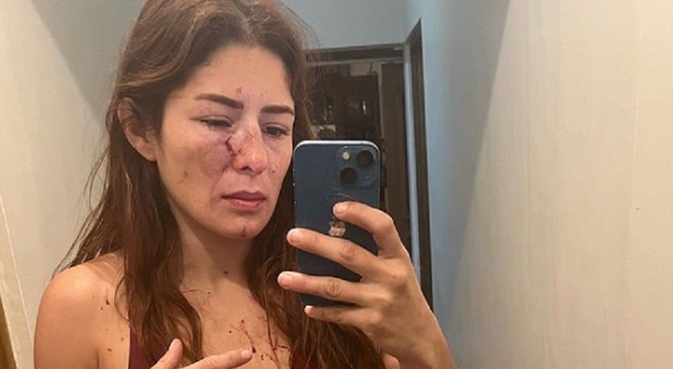 Massacrata dal marito davanti alla figlia di 4 anni: la denuncia choc di Daniela, lottatrice professionista. «Non sono riuscita a difendermi»
