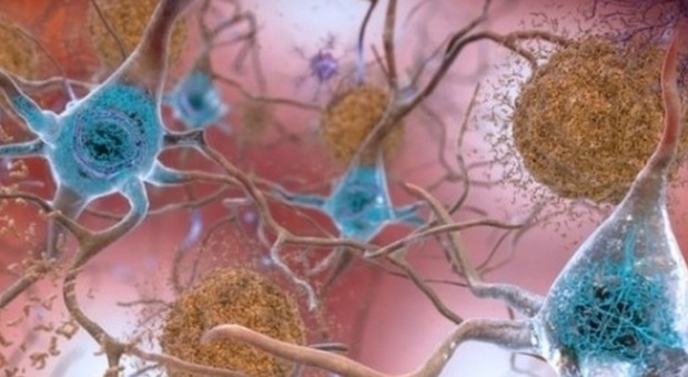 Alzheimer, scoperto il meccanismo con cui i neuroni sfuggono alla "morte": lo studio italiano