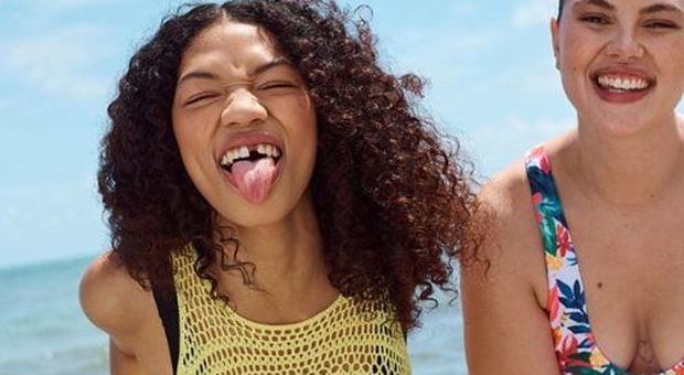 Primark promuove la nuova collezione primavera-estate e sceglie una modella senza un dente