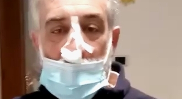 L'imprenditore Antonio Romor è stato medicato al pronto soccorso dell'ospedale