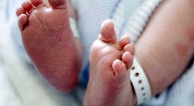 Neonata nasce col feto della gemellina in grembo: il caso rarissimo