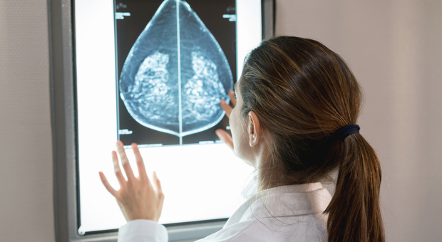 Cancro al seno: un mix di immunoterapia e chemio per battere il "triplo negativo"