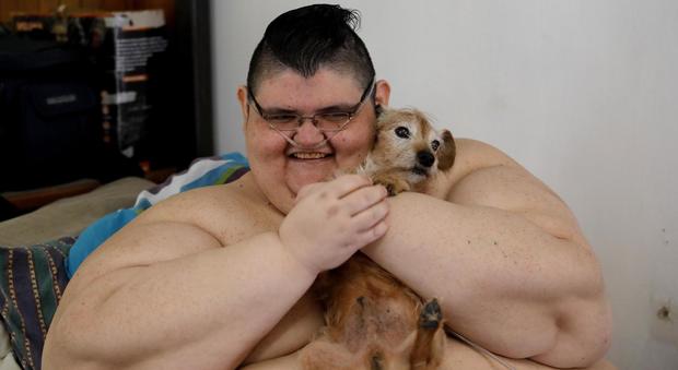 L'uomo più grasso al mondo è dimagrito: ha perso 250 kg