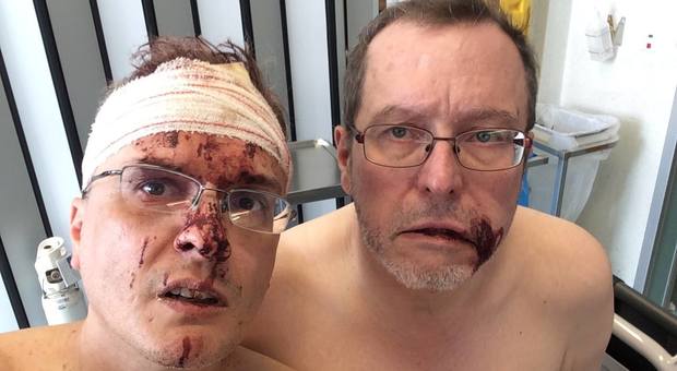 Fumettista italiano e marito picchiati, aggressione omofoba in Belgio