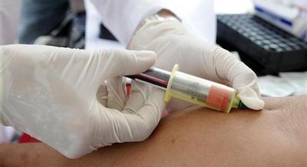 Aids, 120mila persone sieropositive in Italia: un nuovo caso di Hiv ogni due ore