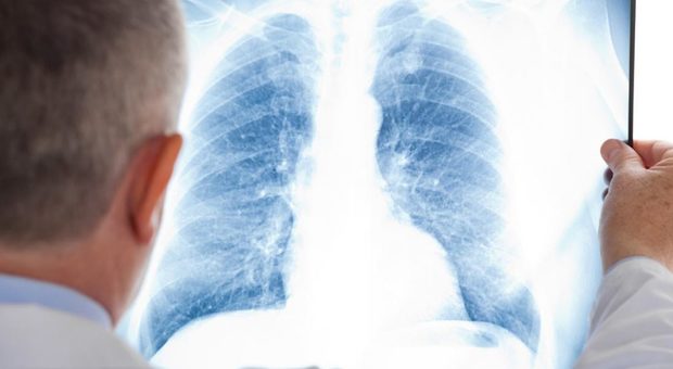 Oltre 150 casi di polmonite, paura nel Bresciano. «Possibile batterio nell'acqua potabile»