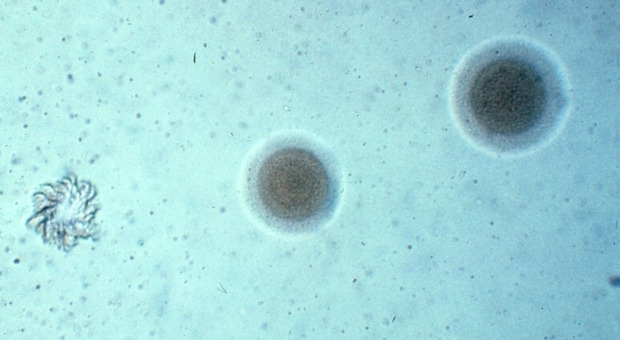Polmoniti, due bambini contagiati da Mycoplasma in Italia. Cosa sta succedendo in Cina e nel mondo