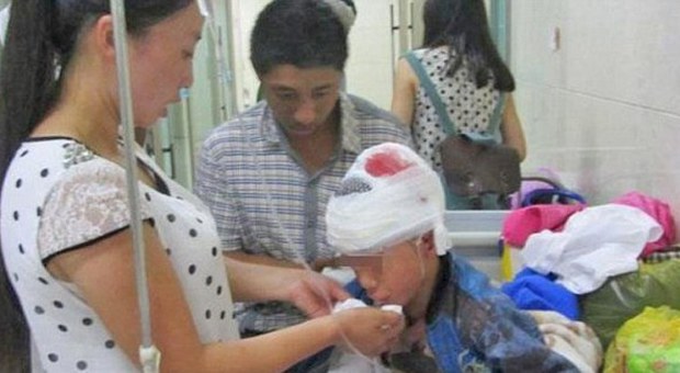 Insegnante picchia a sangue quattro bambini con un libro: uno ricoverato con il cranio fratturato