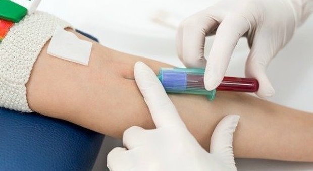 Coronavirus a Napoli, esami del sangue a 120 euro: bloccato centro diagnostico