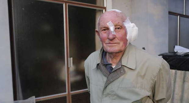 Anziano picchiato e rapinato di 80 euro e della tv. L'allarme lanciato dopo sei ore