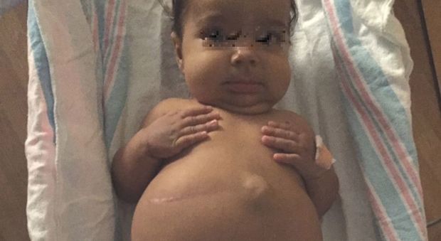 Pubblica le foto choc della figlia in ospedale, il motivo commuove il web
