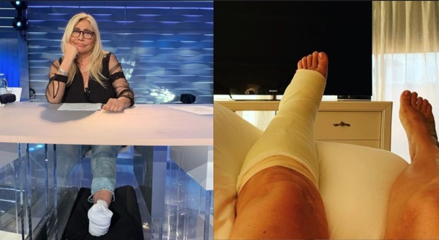 Mara Venier, il piede è rotto: «Una bella frattura». La foto ingessata dall'ospedale