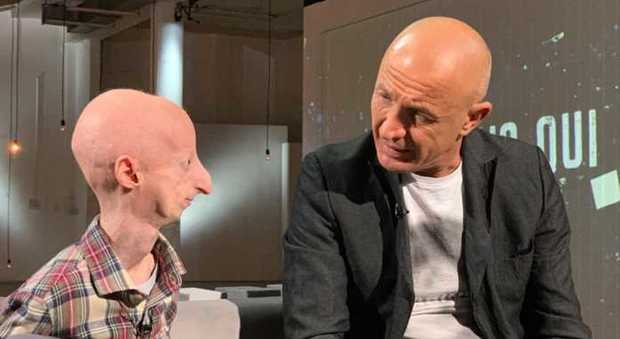 Sammy Basso spiega in diretta tv la progeria: «Vivo con leggerezza, preferisco le domande alla curiosità morbosa»