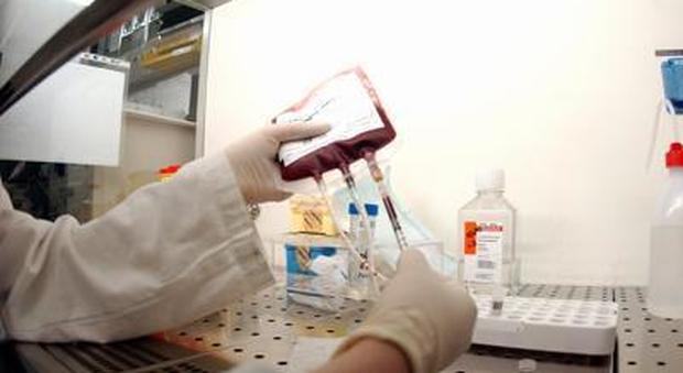 Ictus, ricercatori italiani scoprono l'enzima killer