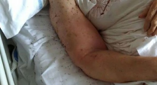 A letto tra le formiche al San Paolo Salvini: «Licenziare i resposnsabili»