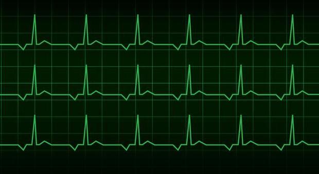 Napoli, micromonitor cardiaco iniettato a una 12enne per prevenire la morte cardiaca improvvisa