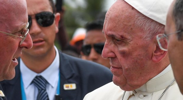Papa Francesco sbatte la faccia sulla papamobile: ferito sullo zigomo e sul sopracciglio
