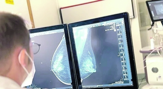 Cancro al seno, l'intelligenza artificiale per le diagnosi: al Policlinico il software innovativo