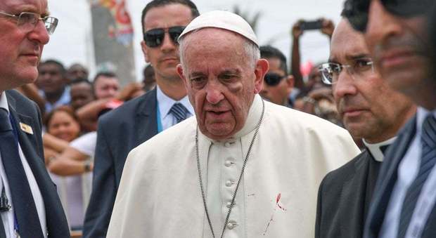 Papa Francesco si ferisce al volto. "Nulla di grave" Video
