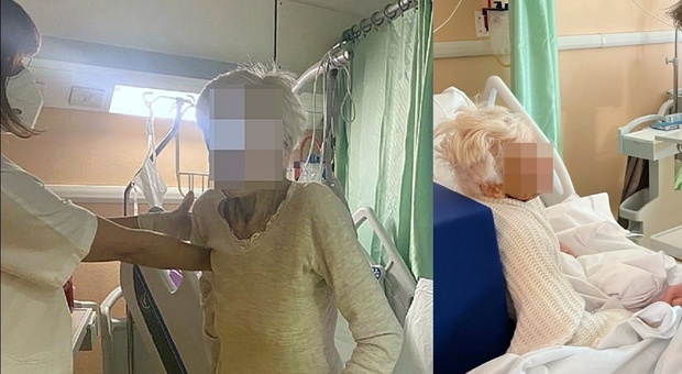 Cade e si rompe il femore a 103 anni: operata, torna a camminare dopo 4 giorni
