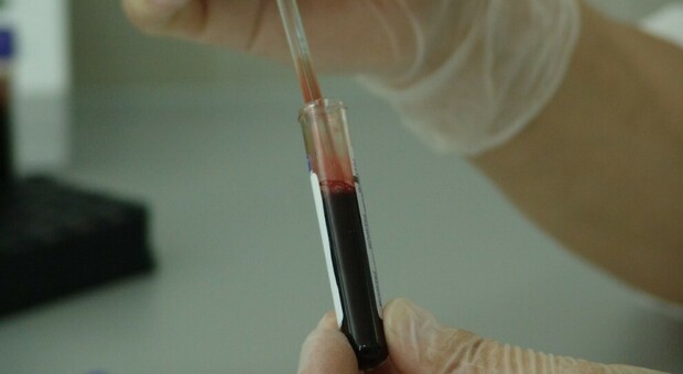 Cancro, l'analisi del sangue che permette di scoprire cinque tipi diversi in anticipo di quattro anni