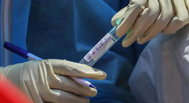 Coronavirus, 30 morti e 259 casi positivi in più: 156 in Lombardia, 46 in Emilia Romagna. Risalgono le terapie intensive: +2