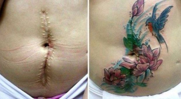 Tatuaggi gratis per coprire le cicatrici: il regalo per le donne vittime di violenza