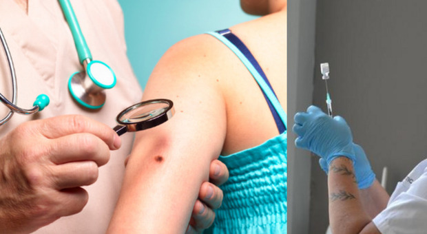 Vaccino per il melanoma in arrivo? L'esperto Rappuoli: «Tra cinque anni potrebbe essere pronto: avrà risultati positivi ma costi elevati»